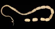 Image of a tapeworm