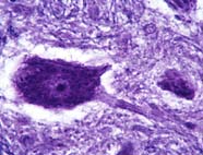 Image of a neuron
