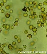 Image of zooxanthellae